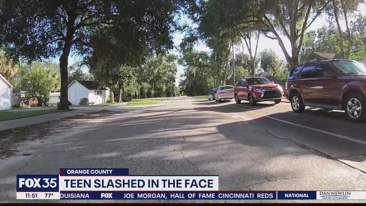 Teen slashed in face with knife by stranger