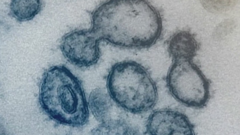 Virus variants in NYC