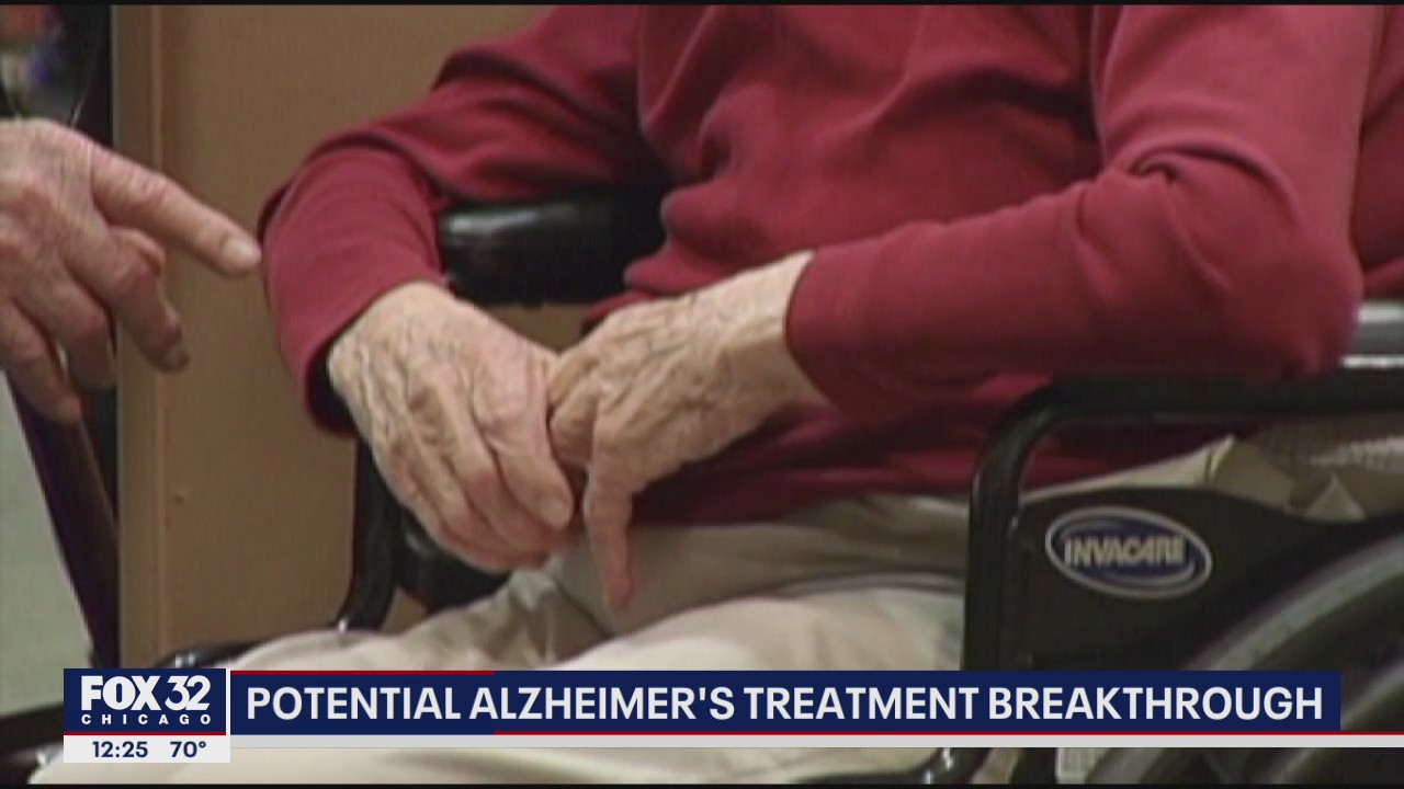 Chicago-area doctors on verge of potential Alzheimer's treatment breakthrough
