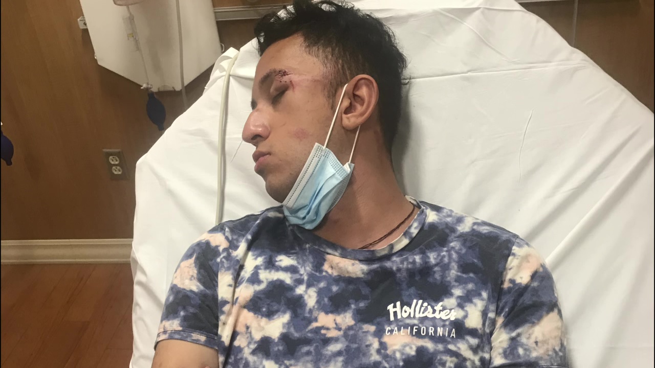 Police searching for man who robbed, beat deaf man at bus stop