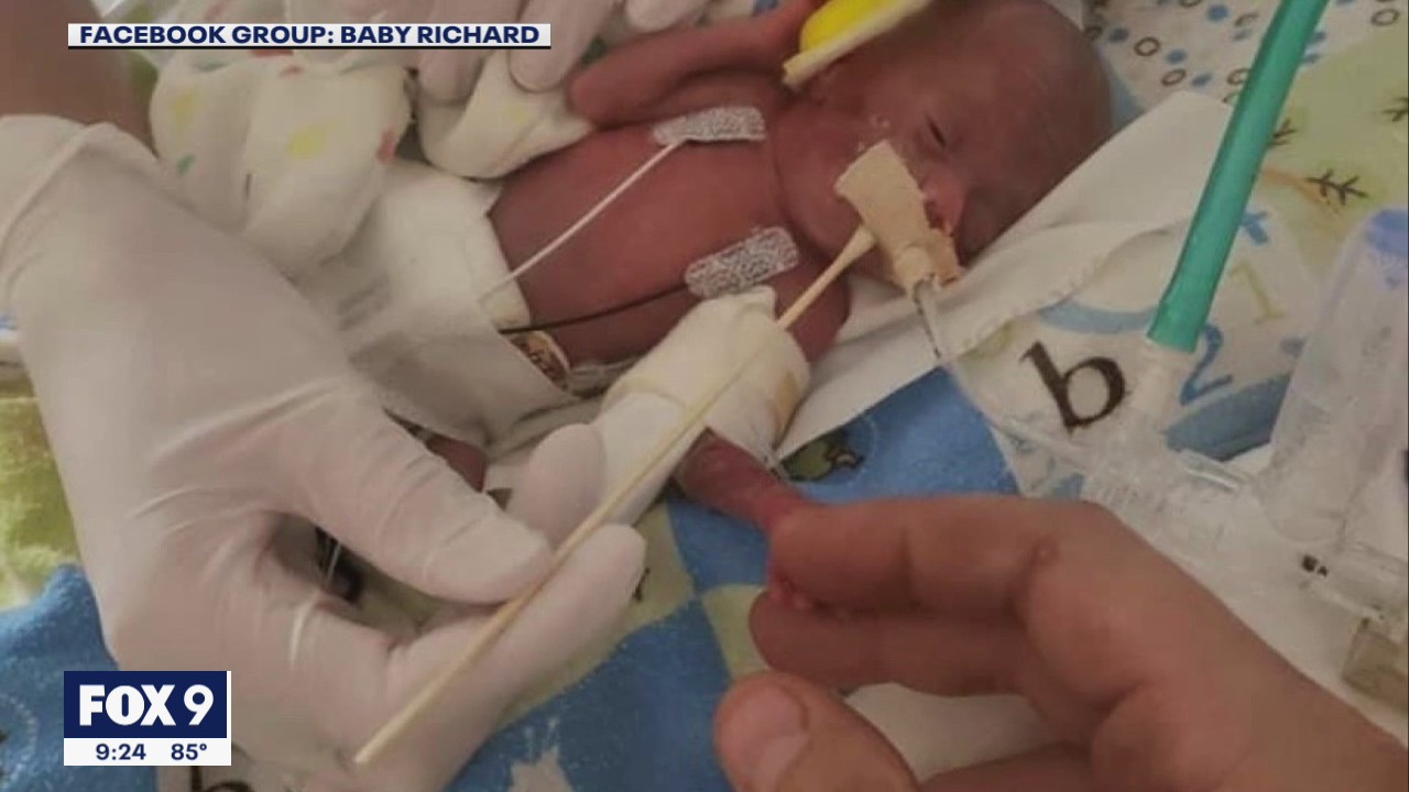 The world’s most premature baby born in Minnesota celebrates 1st birthday