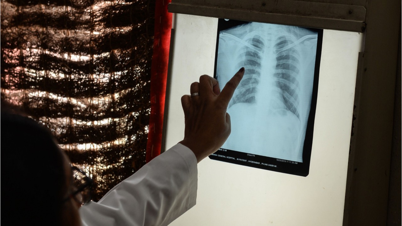 5 deadly diseases that made a comeback in the last decade