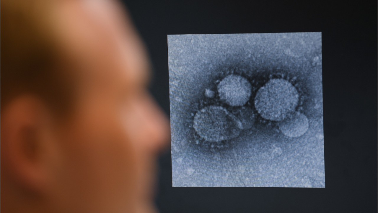 CDC monitoring dozens of possible patients for coronavirus
