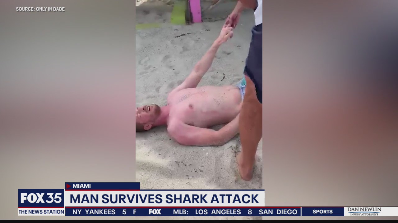 Man survives shark attack