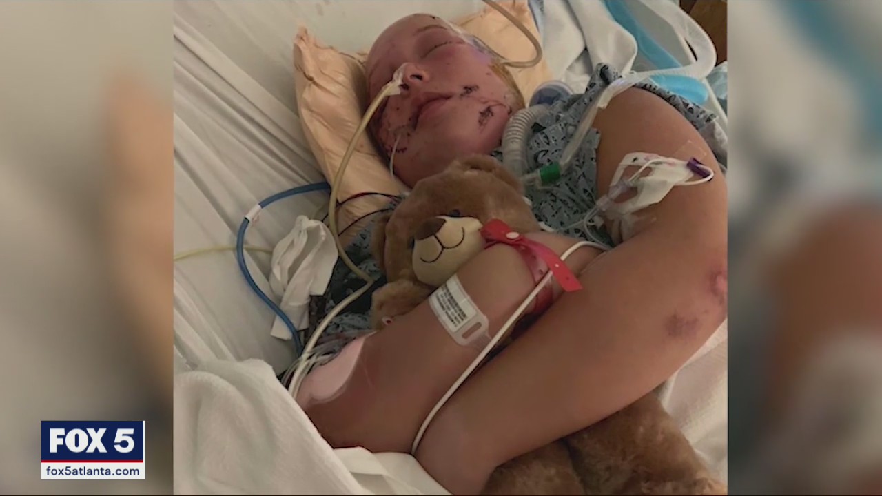 Teenage girl attacked by two pitbulls