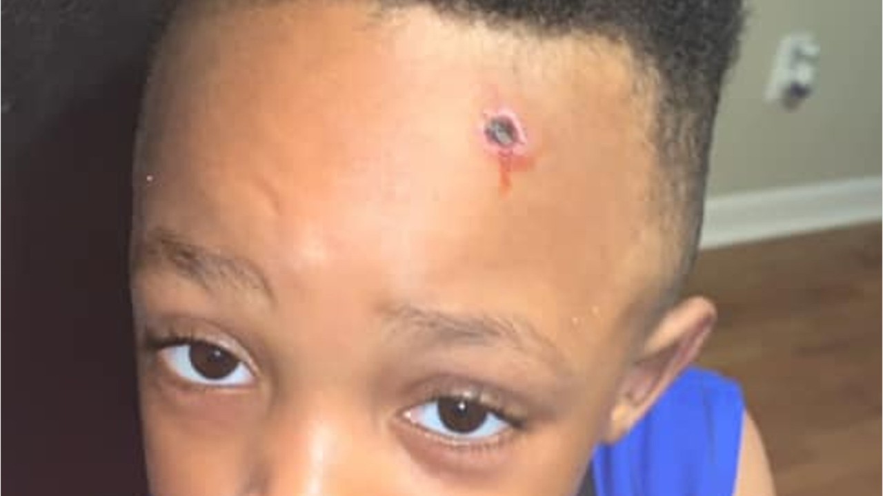 Mother outraged after teacher paints fake bullet hole on her son's forehead