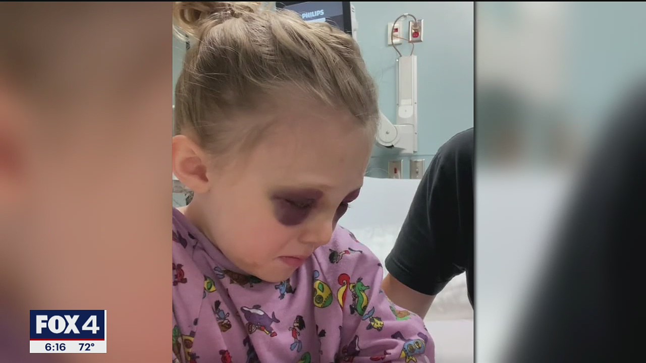 3-year-old girl survives freak accident at Parker equestrian center