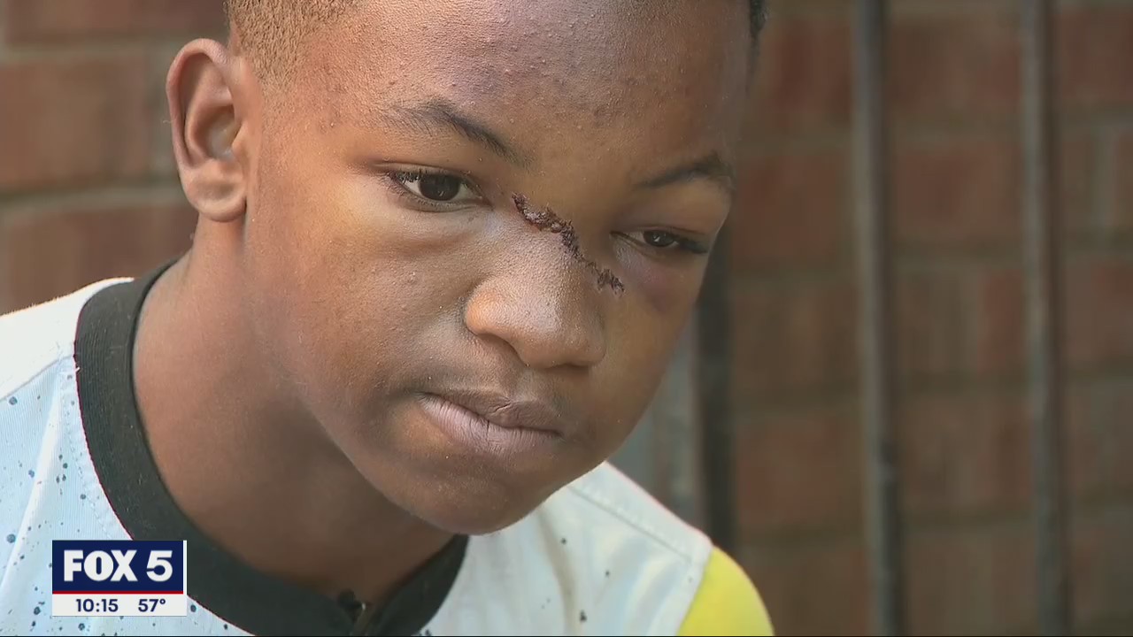Teen hit by car