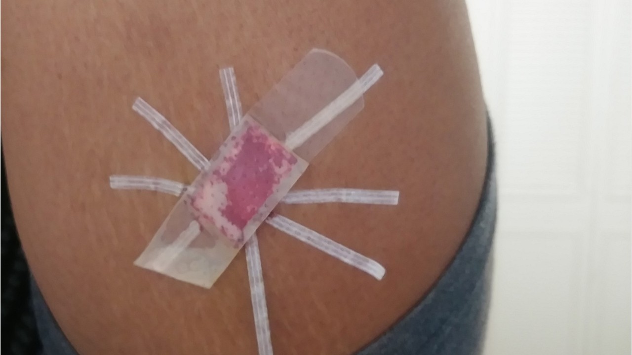 Teen given botched birth control implant at school without parents’ permission, mother says