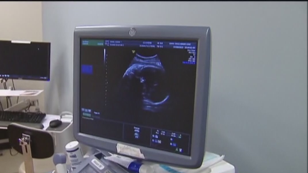 Abortion 'heartbeat bill' wins critical vote in Texas House.