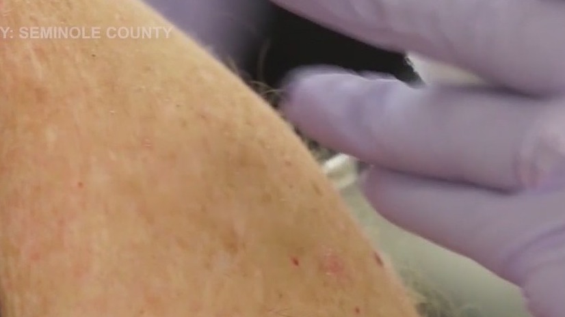 CDC: Millions skipping 2nd dose of Pfizer, Moderna vaccine