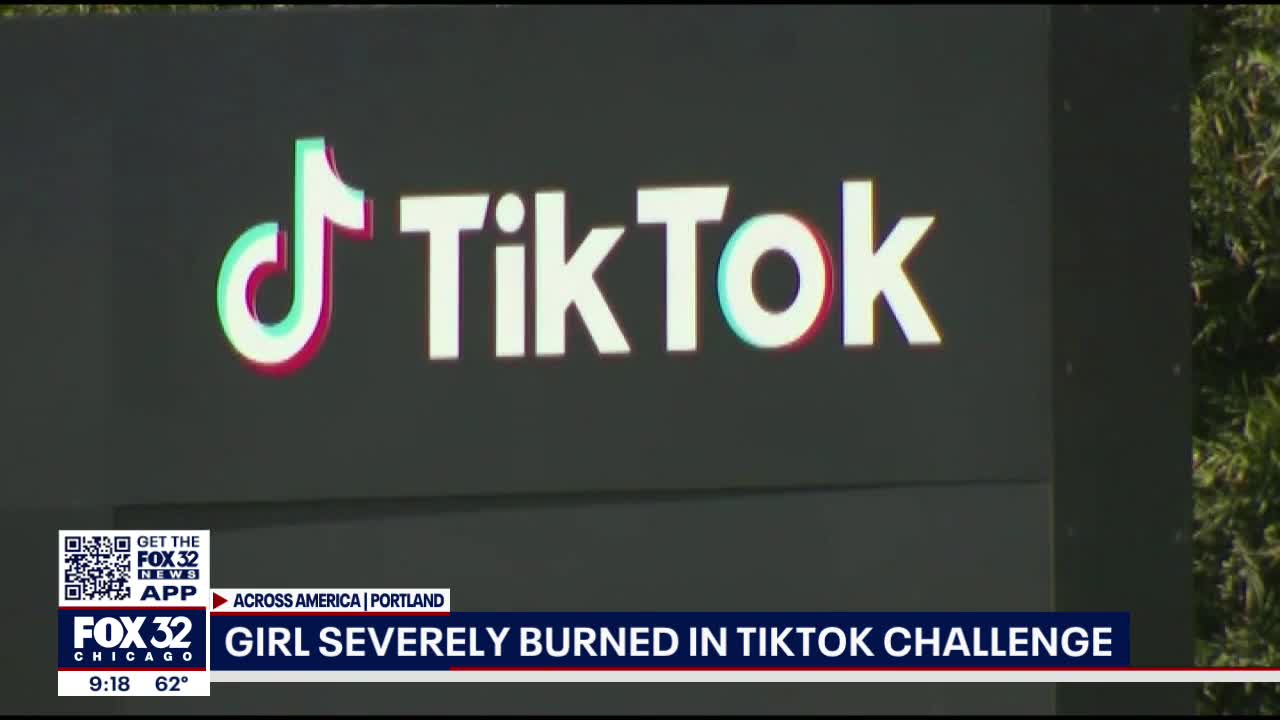 Oregon teen hospitalized with severe burns after attempting viral TikTok fire challenge